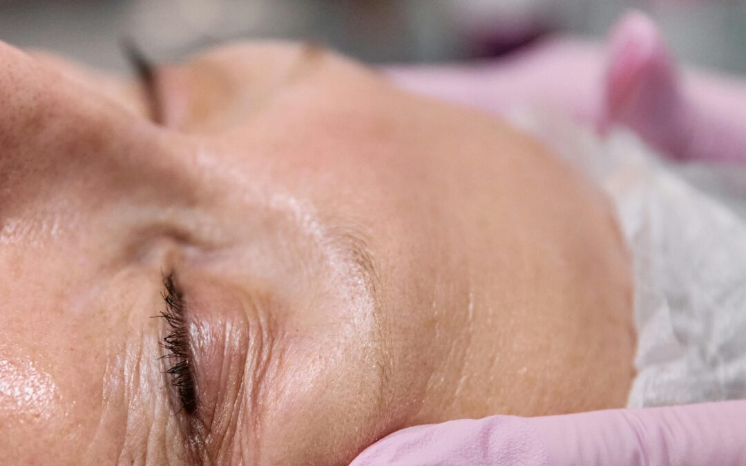 Como tratar tus ojeras