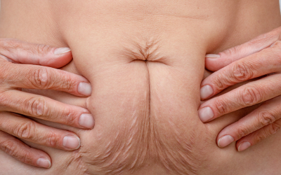 Sin título (400 x 300 px) (1)