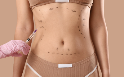 Sin título (400 x 300 px) (2)