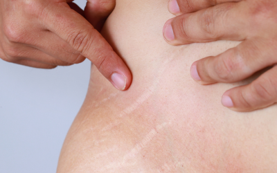 Sin título (400 x 300 px) (5)