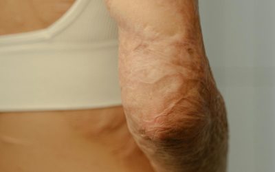 pexels-ron-lach-8628397